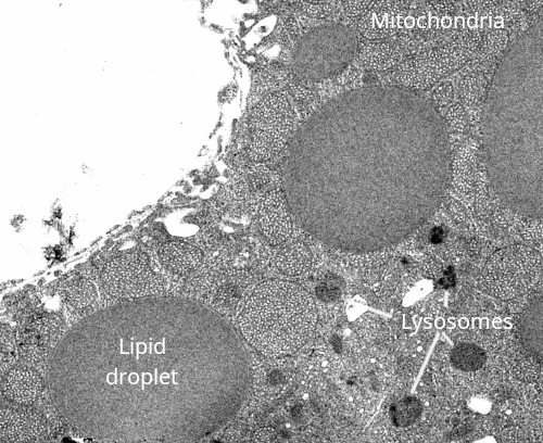 Lysosomes