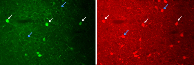 Inmunofluorescence