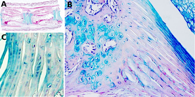 Fibrocartílago