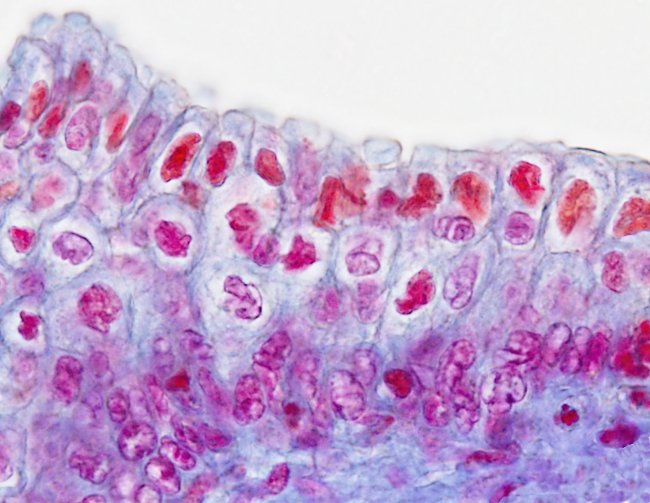 Epitelio estratificado primático