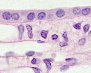 Papila renal