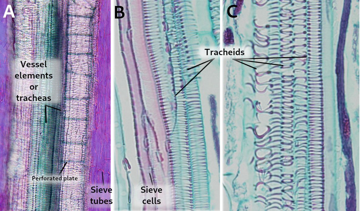 Tracheas/Tracheids/Sieve cells