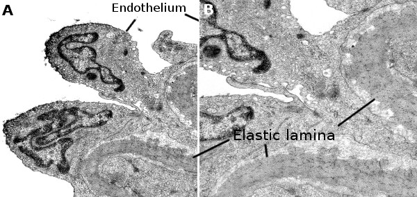 Arteriole endothelium