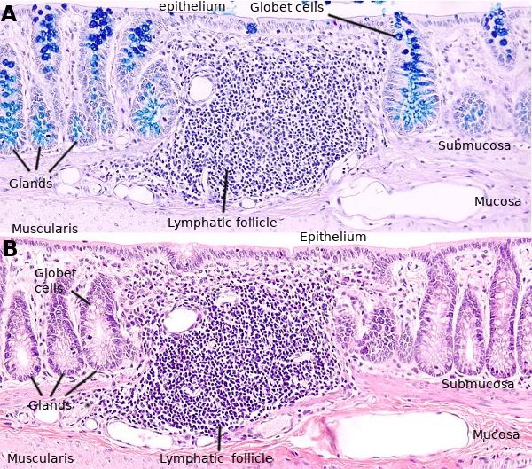 Large intestine