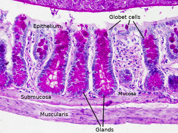 Large intestine