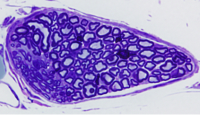 Peripheral nerve