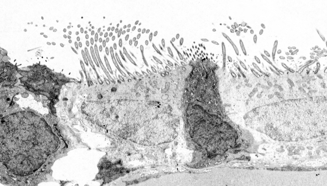 Transmission electron microscopy images of cilia