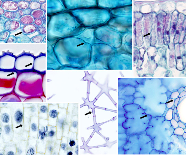 Primary cell wall