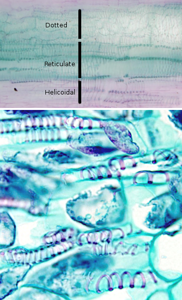 Thickenings of the secondary cell wall