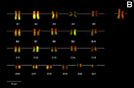 Karyotype