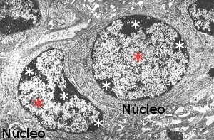 Chromatin