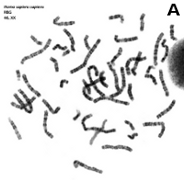 Chromosomes, Giemsa