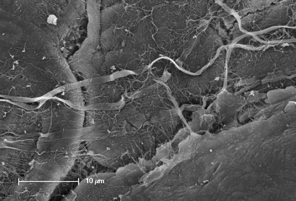 Extracellular matrix