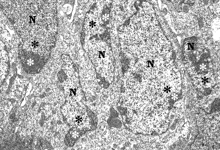 Chromatin