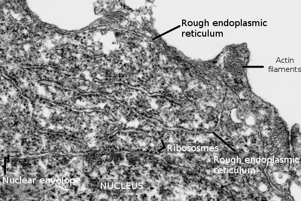 Endoplasmic reticulum 