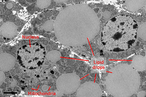 lipid droplets