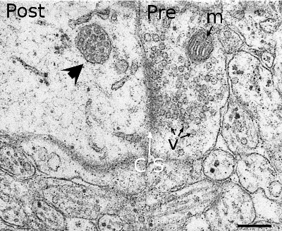 Multivesicular bodies