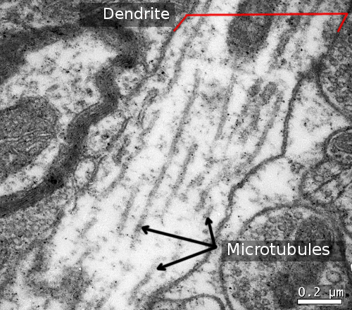 Microtubules