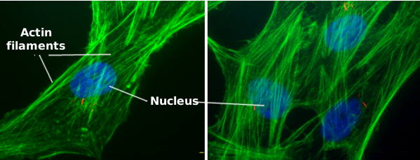  Actin filaments