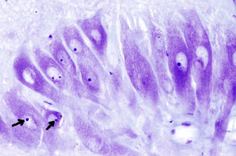 Nucleolus in neurons