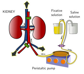 Perfusion