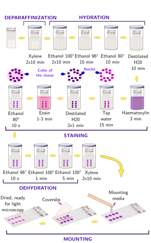 Hematoxylin-eosin staining