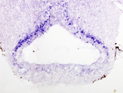  In situ hybridization