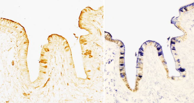 Lectin staining