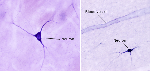 Mouse brain