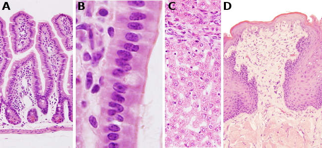 Hematoxilina-eosina