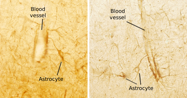 Astrocitos