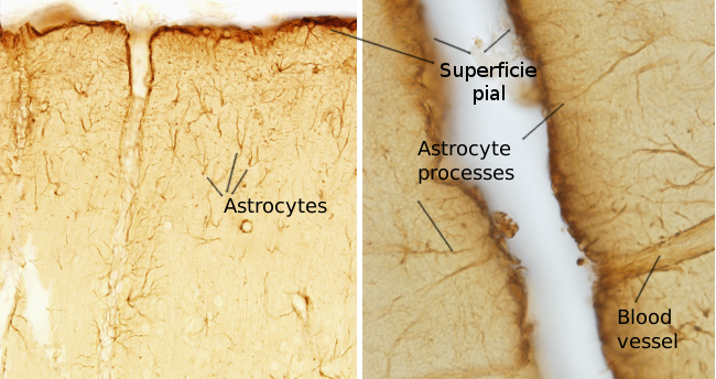 Astrocytes