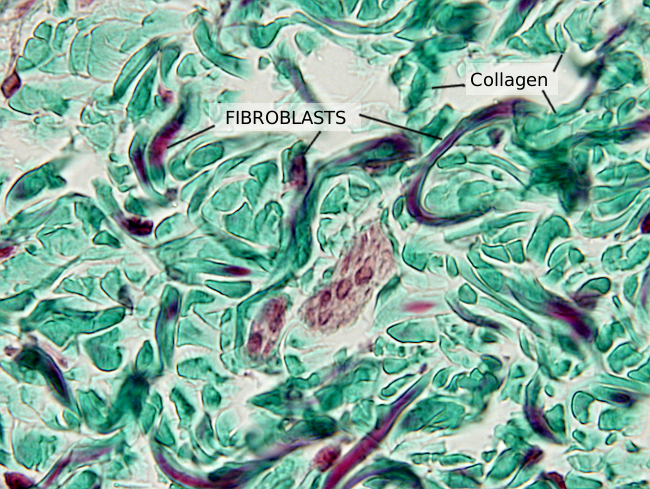 Fibroblast