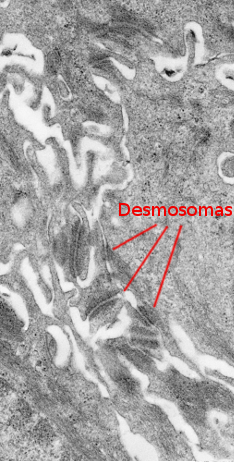 Desmosomes