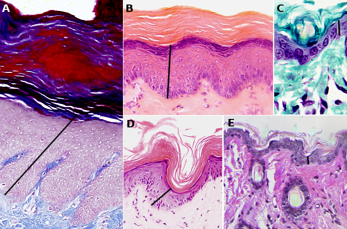 Epidermis