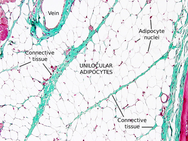 Adipocytes