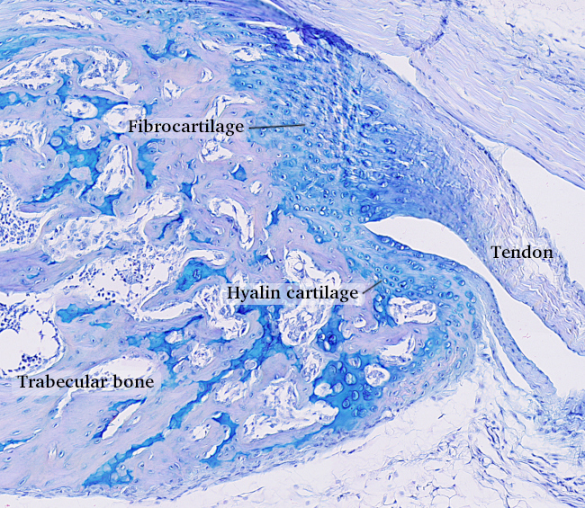 Fibrocartilage