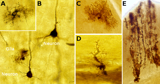 Astrocytes