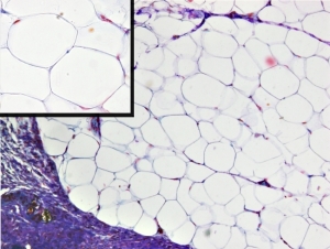 White adipose tissue