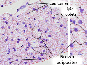 Brown adipose tissue