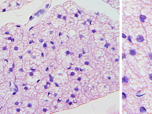 Brown adipose tissue