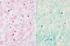 Mucous connective