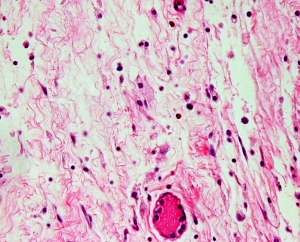 Loose connective tissue