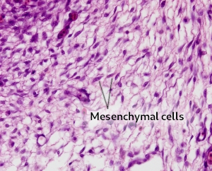 Mesenchymal connective