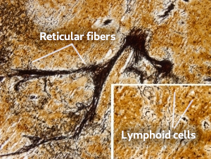 Reticular connective