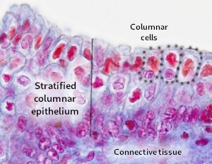 Stratified columnar epithelium