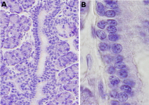 Stratified cuboidal epithelium