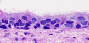 Pseudostrafied epithelium