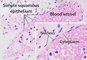 Simple squamous epithleium