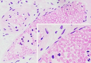 Simple squamous epithleium